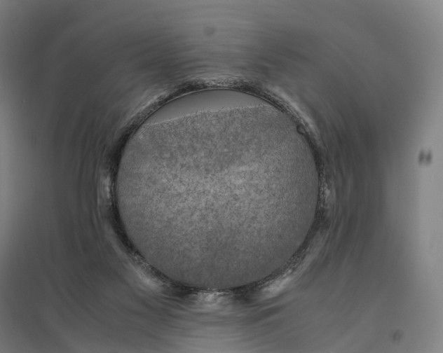 X0000095120117200712301810