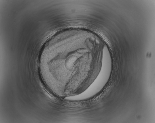 X0000095120397200712301805