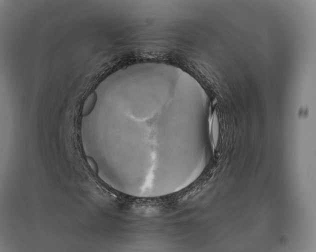 X0000095120817200712301758