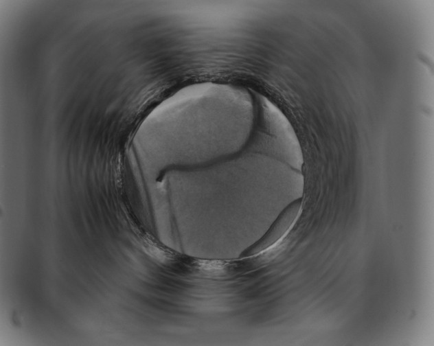 X0000095120144200801041231