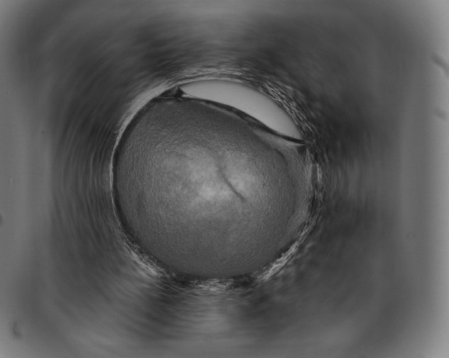 X0000095120148200801041231