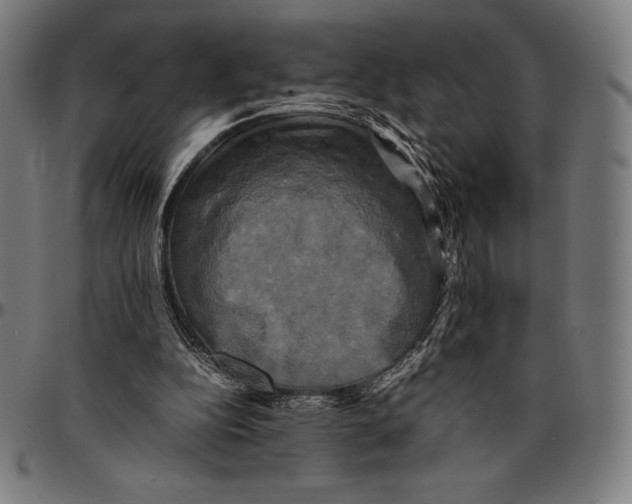 X0000095120152200801041231