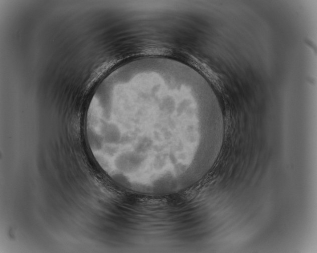 X0000095120155200801041231