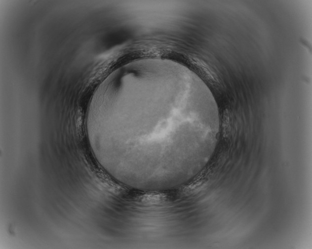 X0000095120314200801041229