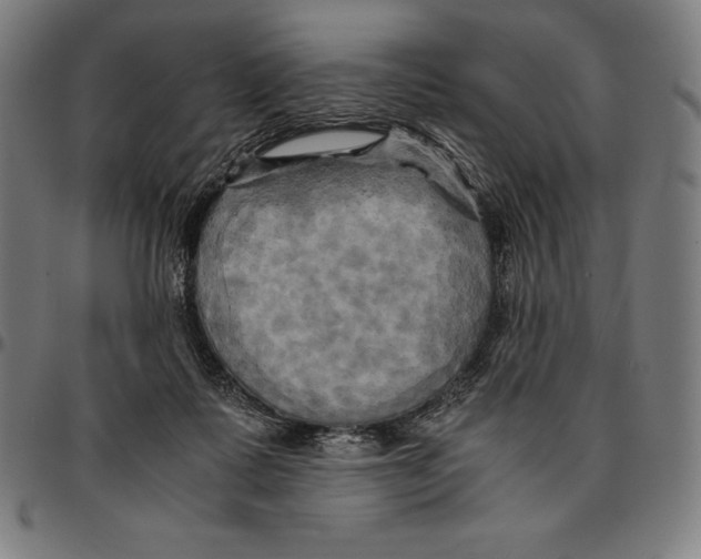 X0000095120315200801041229