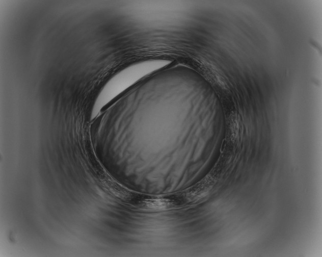 X0000095120316200801041229