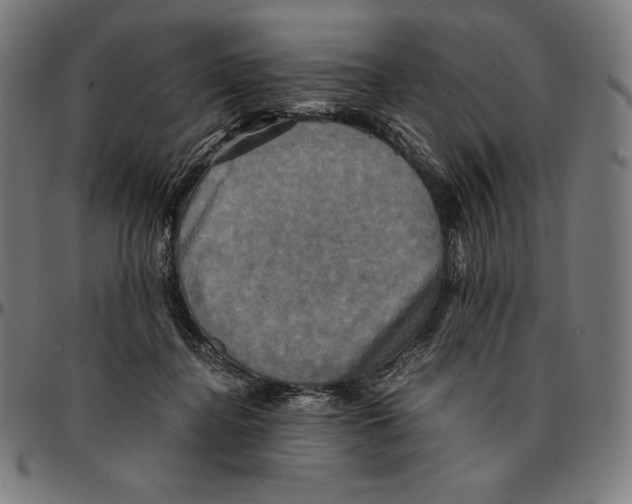 X0000095120364200801041228