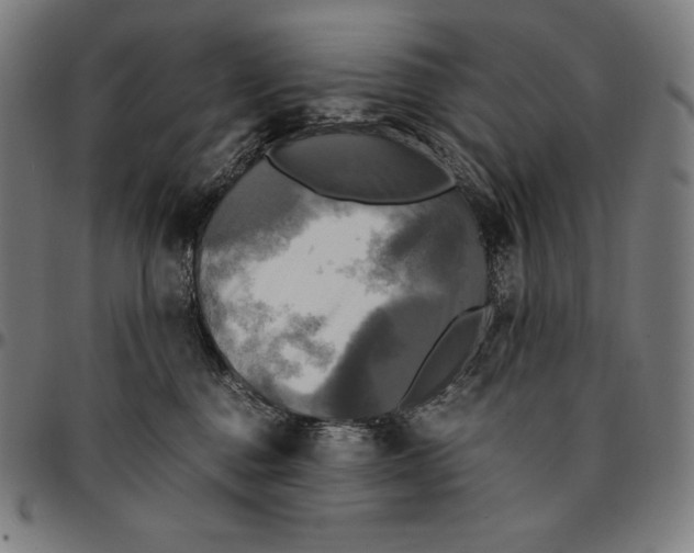 X0000095120376200801041228