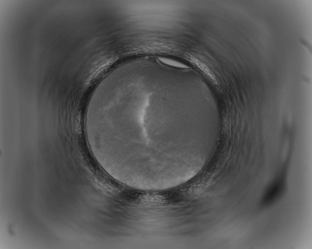 X0000095120403200801041228