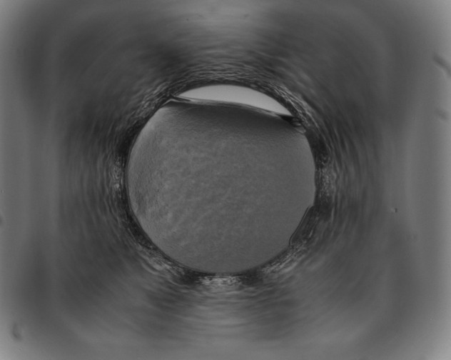 X0000095120517200801041226