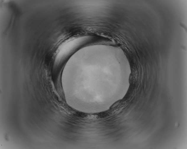 X0000095120609200801041225