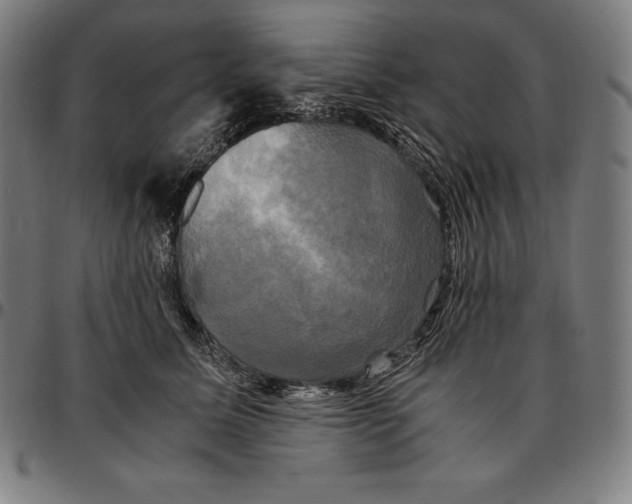 X0000095120611200801041225