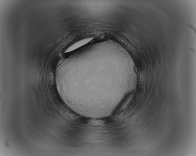 X0000095120617200801041224