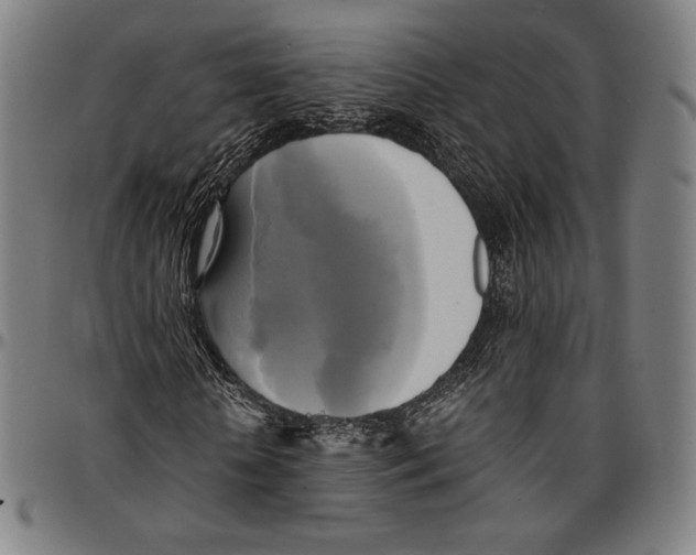 X0000095120818200801041221