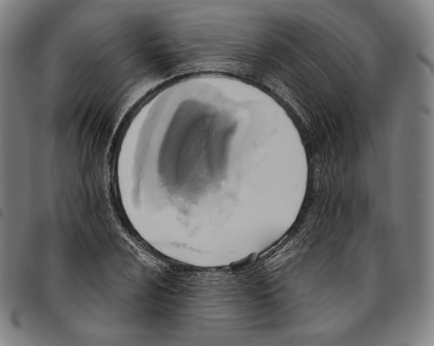 X0000095121024200801041218