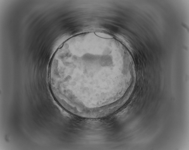 X0000095121103200801041217