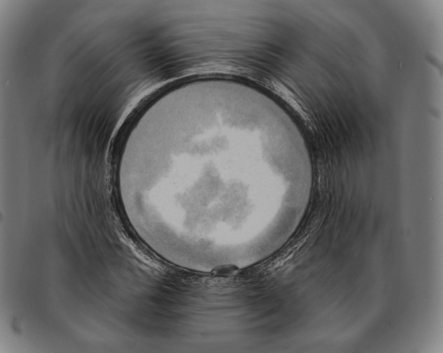 X0000095121116200801041217