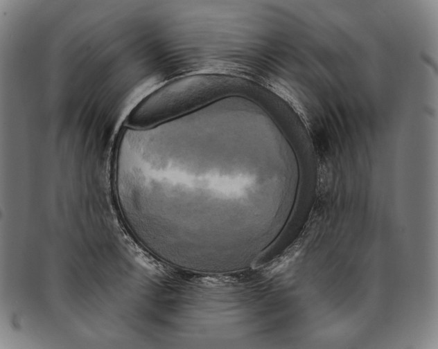 X0000095121138200801041217