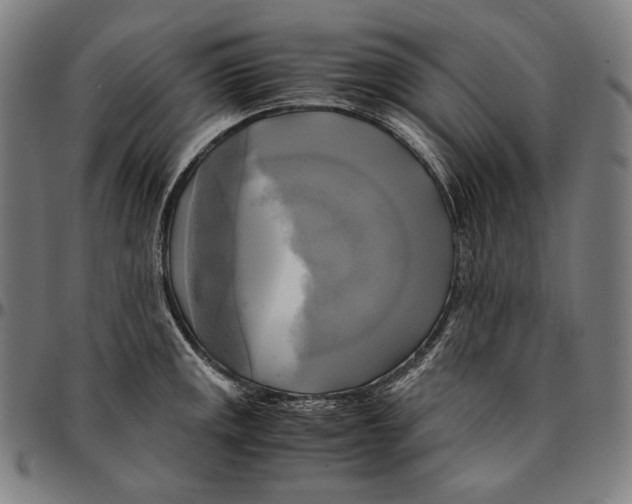 X0000095121141200801041217