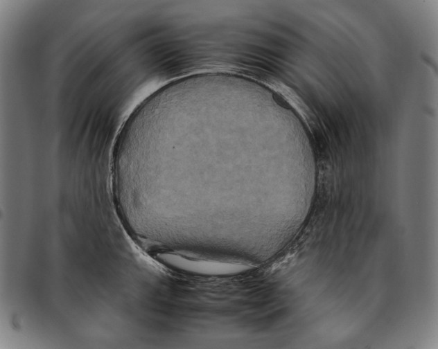 X0000095121143200801041217