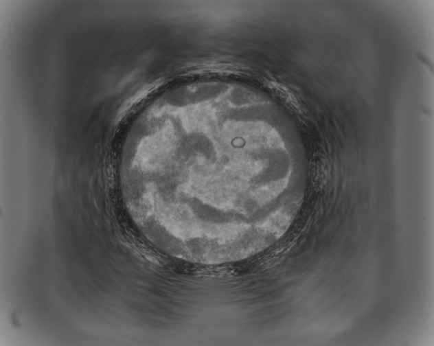 X0000095121159200801041217