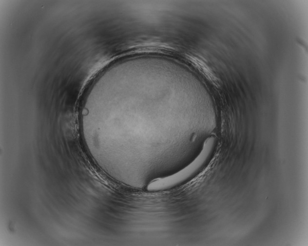 X0000095121164200801041217