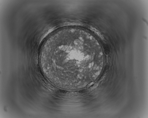 X0000095121165200801041217