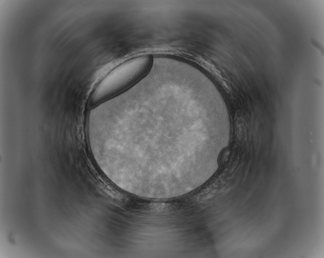 X0000095121176200801041216