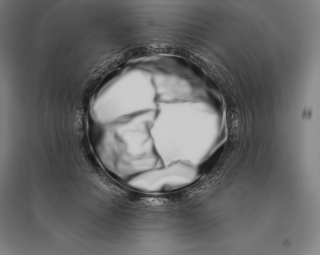 X0000095130654200712301825