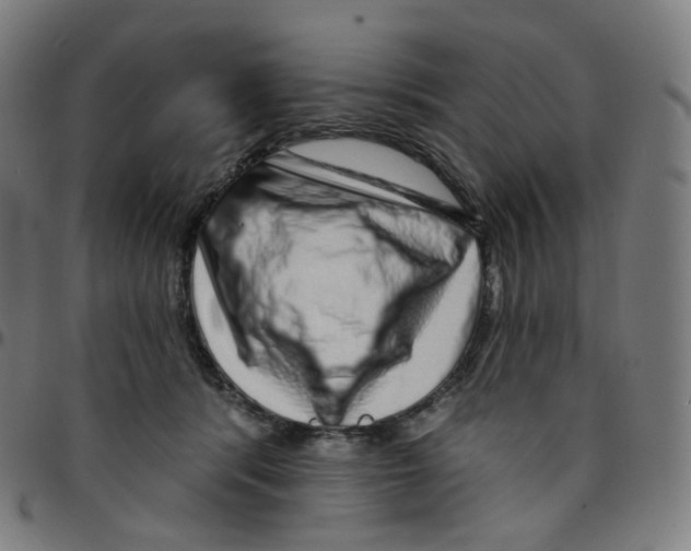 X0000095130416200801041251