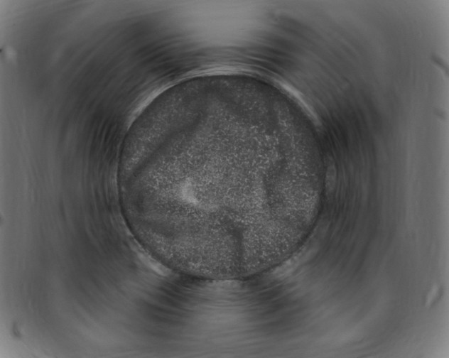 X0000095131417200801041236