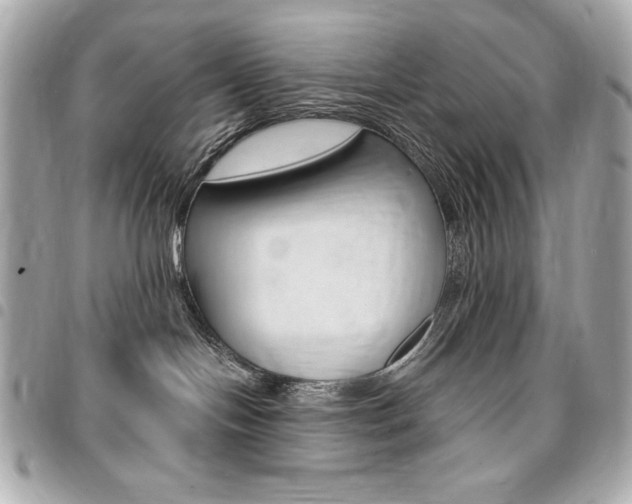 X0000095510094200712140944