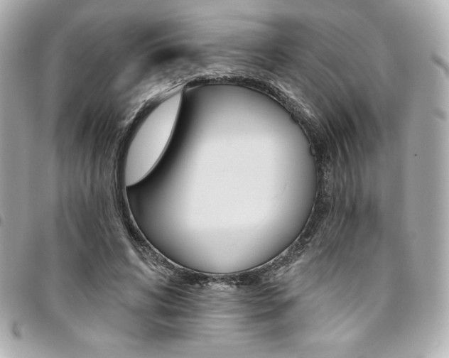X0000095510592200712140936
