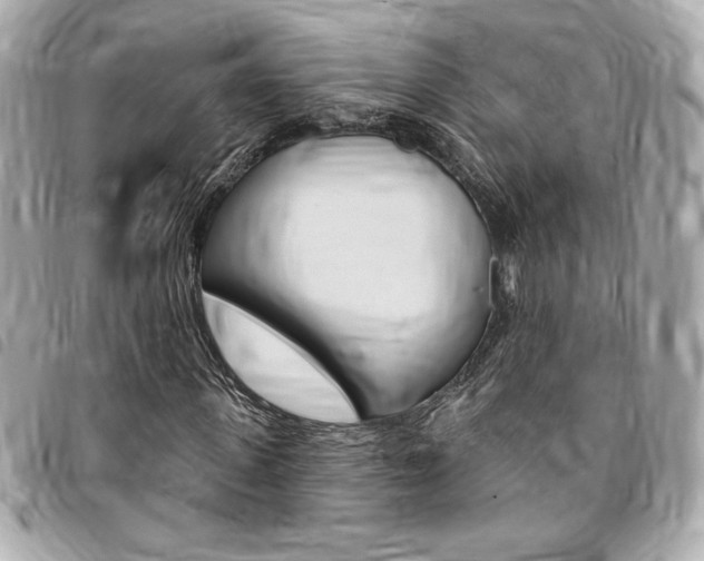 X0000095510915200712140931