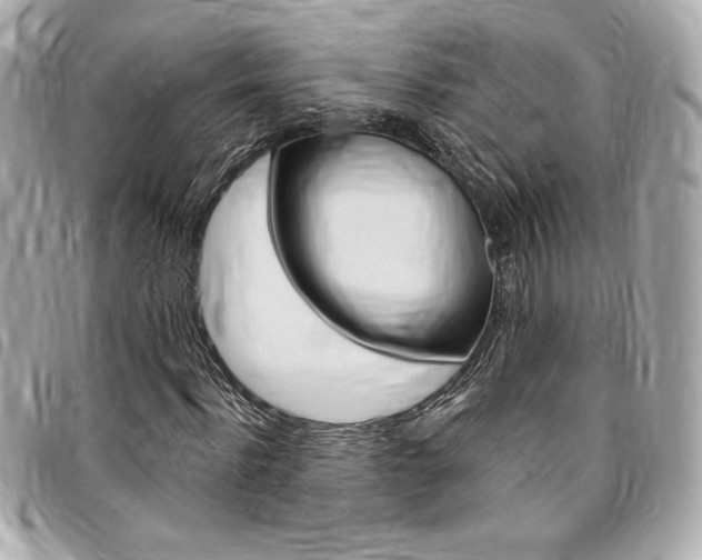 X0000095510916200712140931