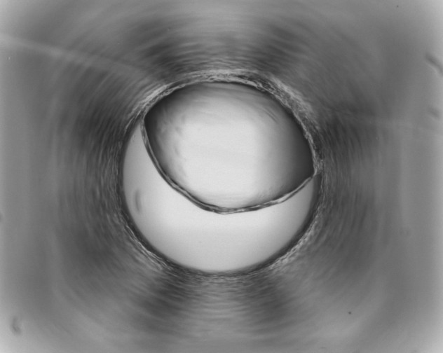 X0000095511169200712140928
