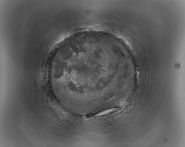 X0000095511159200712141417