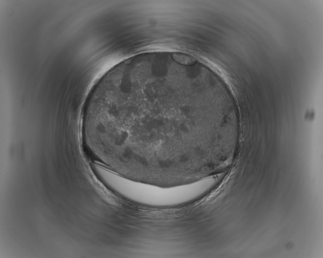 X0000095511179200712141417