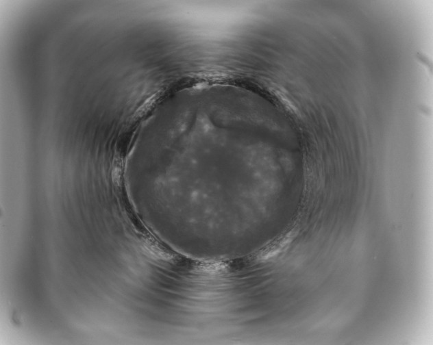 X0000095510576200712281440
