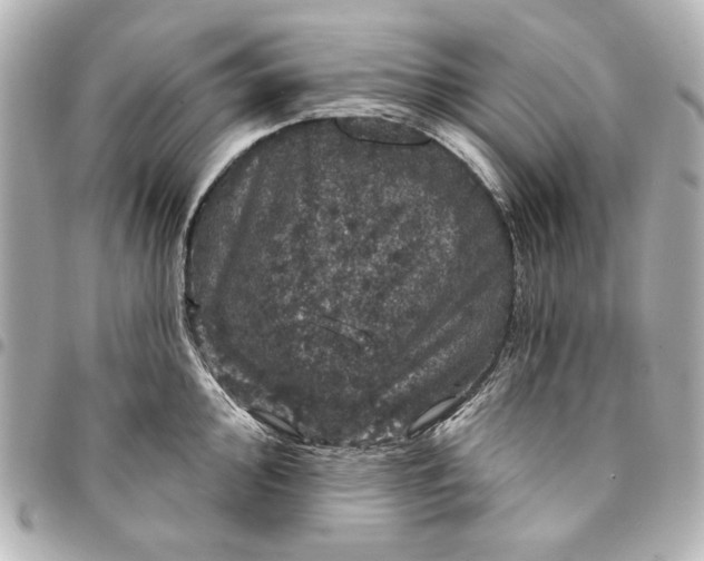 X0000095511000200712281434