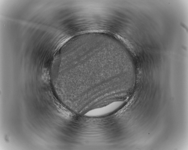 X0000095511169200712281431