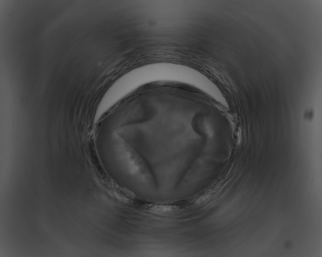 X0000095510332200801041206