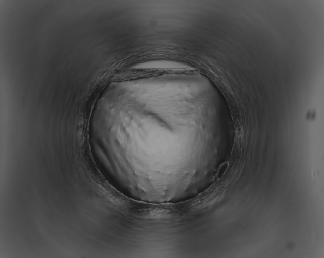 X0000095510462200801041204
