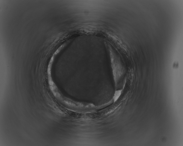 X0000095511009200801041155