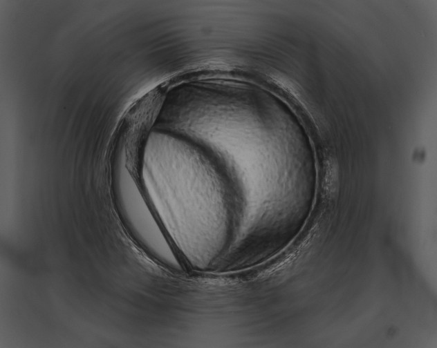 X0000095511018200801041155