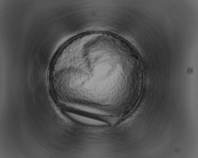 X0000095511030200801041155