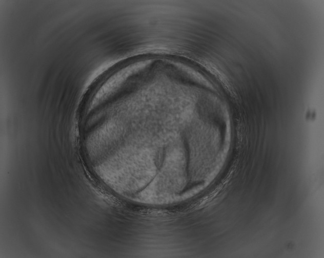 X0000095511070200801041155