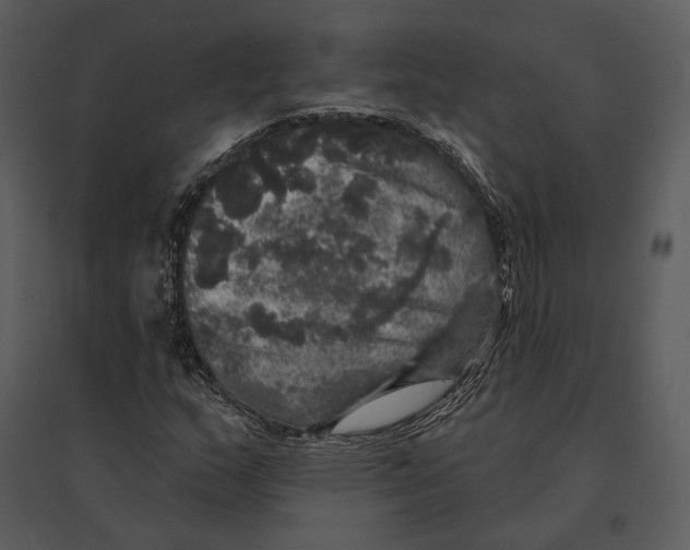 X0000095511159200801041153