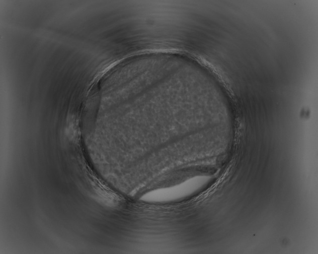 X0000095511169200801041153