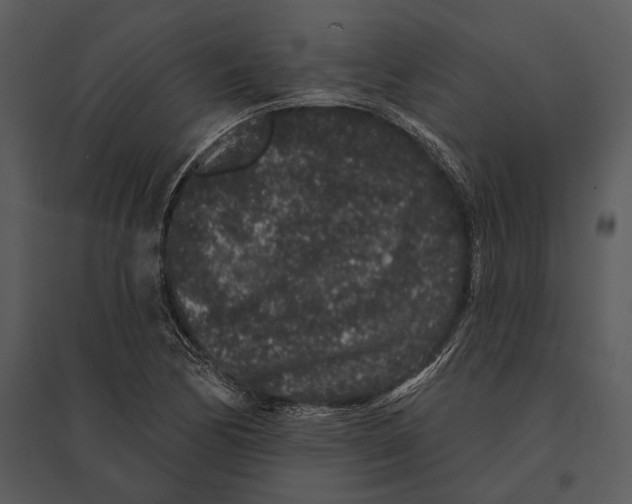 X0000095511170200801041153